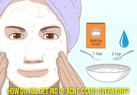 How Do You Get Rid Of Acne Scars Overnight - Verrolyne Training
